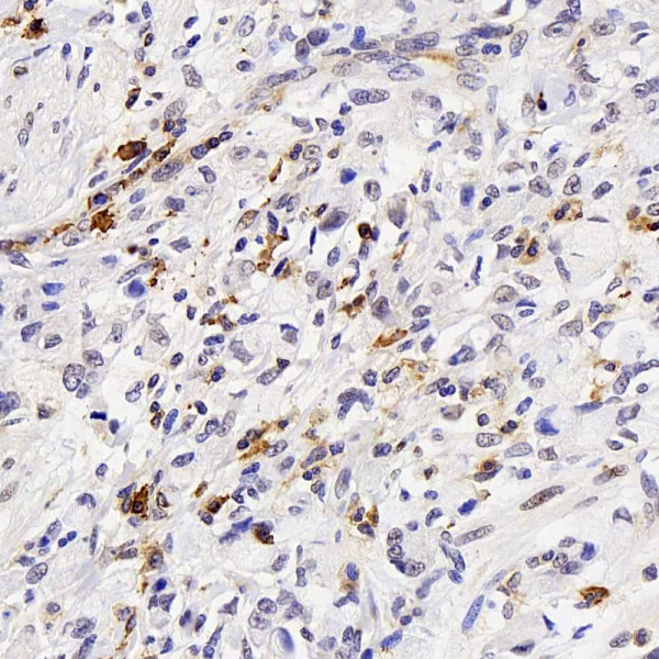 FAS Polyclonal Antibody (E-AB-70336)