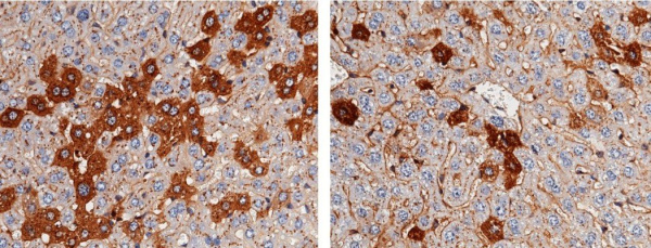 Recombinant Fetuin-A/AHSG Monoclonal Antibody (AN300475P)