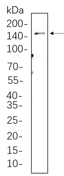 Recombinant LATS1 Monoclonal Antibody (AN300791L)