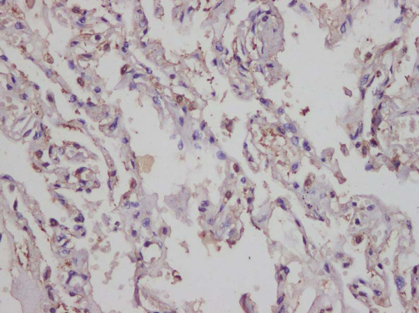 IL-17A Polyclonal Antibody (AN005920L)
