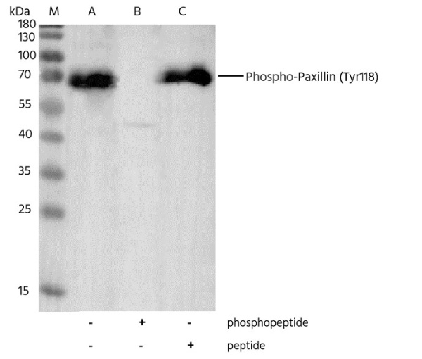 Recombinant Phospho-Paxillin (Tyr118) Monoclonal Antibody (AN300384L)