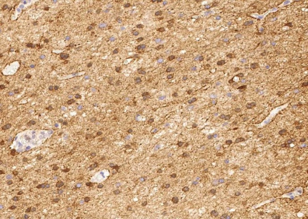 ENO2 Monoclonal Antibody (AN200227P)