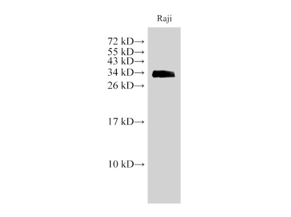 CD74 Polyclonal Antibody (E-AB-40347)