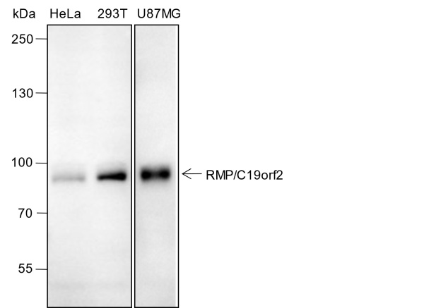 Recombinant RMP/C19orf2 Monoclonal Antibody (AN301683L)