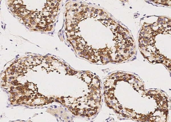 Recombinant GDF-3 Monoclonal Antibody (AN300294P)