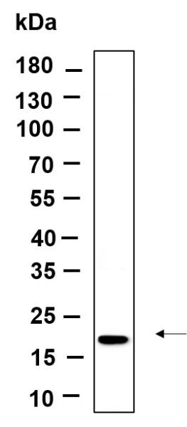 Recombinant Osteocalcin Monoclonal Antibody (AN301385L)