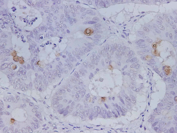 MUC5AC Polyclonal Antibody (D-AB-10374L)