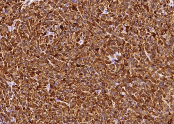 Recombinant S100B Monoclonal Antibody (AN300297P)