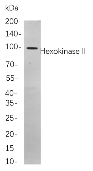 Recombinant Hexokinase II Monoclonal Antibody (AN301070L)