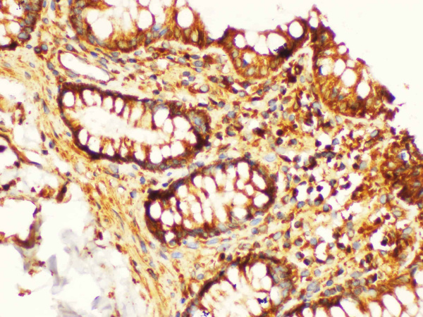 KLK6 Polyclonal Antibody (E-AB-40369)