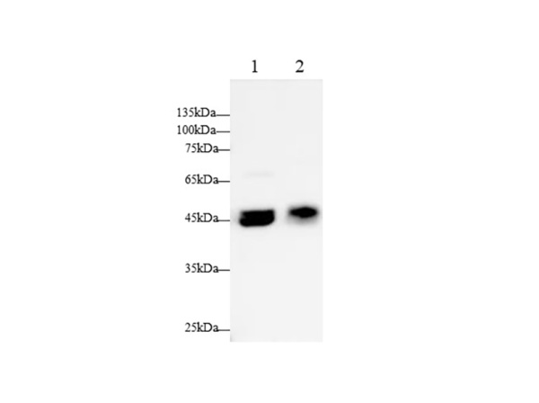 GLα/Galactosidase Alpha Polyclonal Antibody (AN006790L)