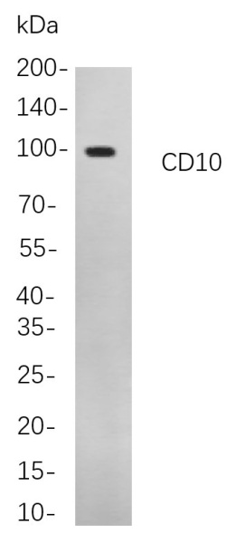 Recombinant CD10 Monoclonal Antibody (AN300845L)