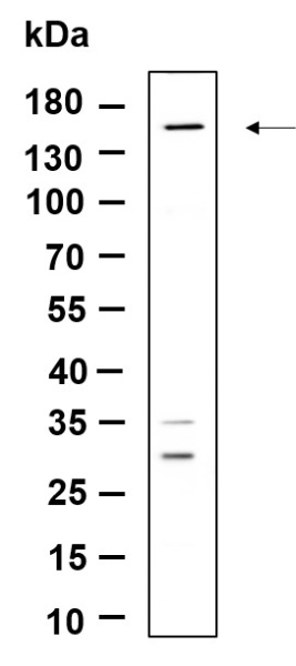 Recombinant Drosha Monoclonal Antibody (AN301162L)