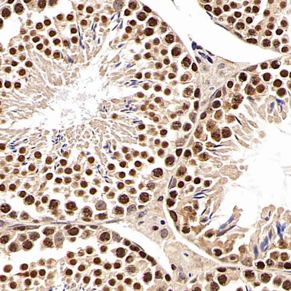 SNAI1 Polyclonal Antibody (E-AB-70119)