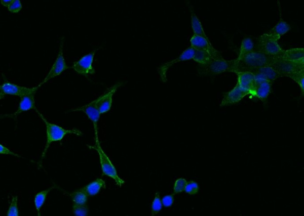 PSMA Monoclonal Antibody (AN200061P)