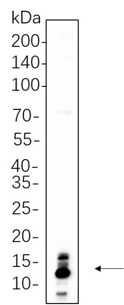 Recombinant S100B Monoclonal Antibody (AN301361L)
