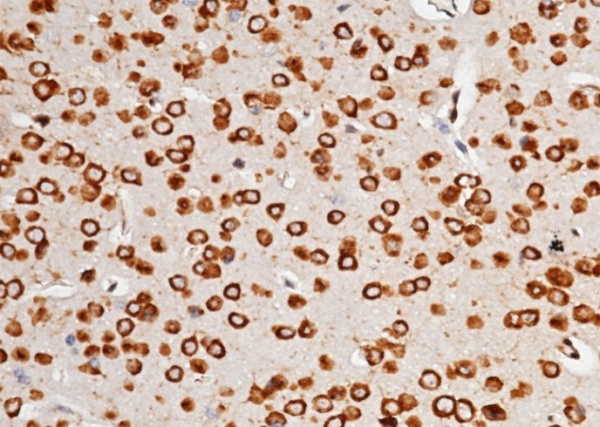 Recombinant AGO2/Argonaute 2/EIF2C2 Monoclonal Antibody (AN300165P)