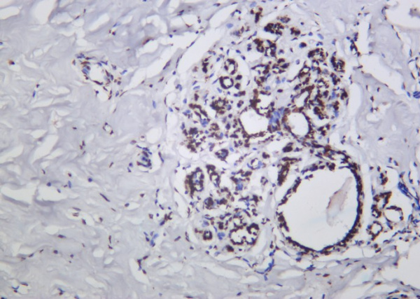 Recombinant Phospho-p53 (Ser15) Monoclonal Antibody (AN301251L)