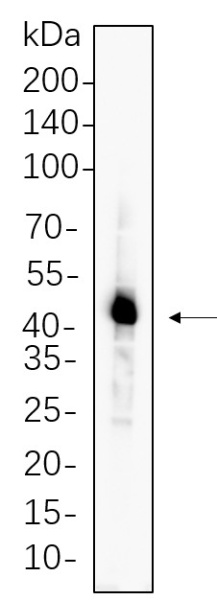Recombinant Caspase-1 Monoclonal Antibody (AN300732L)