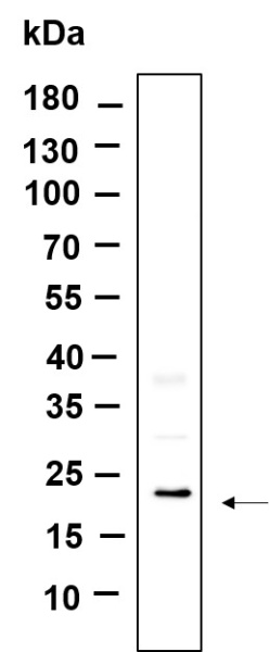 Recombinant TXD12 Monoclonal Antibody (AN301120L)