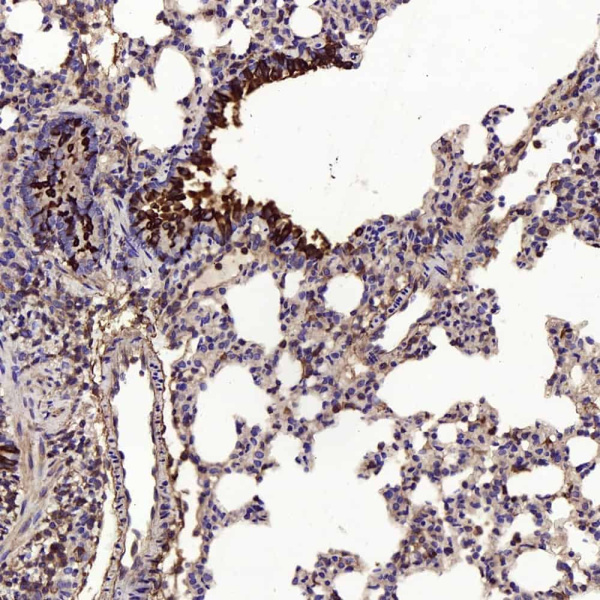 MMP9 Polyclonal Antibody (E-AB-70059)