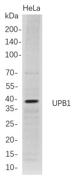 Recombinant UPB1 Monoclonal Antibody (AN300772L)