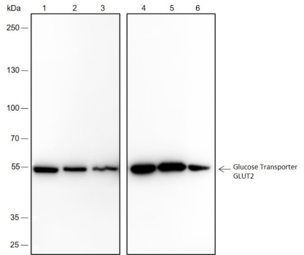 Recombinant GLUT2 Monoclonal Antibody (AN301695L)