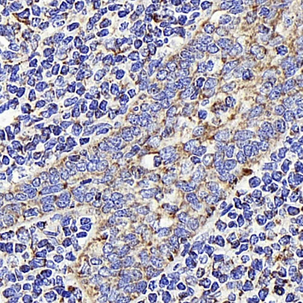 AIFM1 Polyclonal Antibody (E-AB-70181)