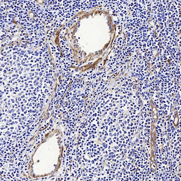 LDLR Polyclonal Antibody (E-AB-70239)