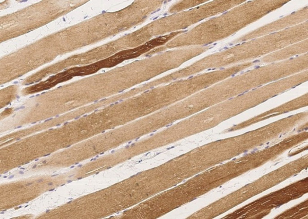 MAPKAPK3/MK3 Monoclonal Antibody (AN200072P)