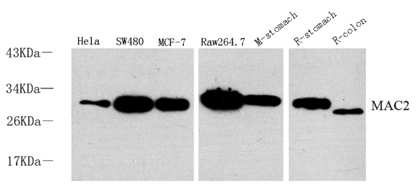 Galectin 3 Polyclonal Antibody (E-AB-70106)