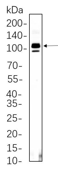 Recombinant SATB2 Monoclonal Antibody (AN300604L)
