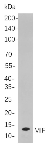 Recombinant MIF Monoclonal Antibody (AN300943L)
