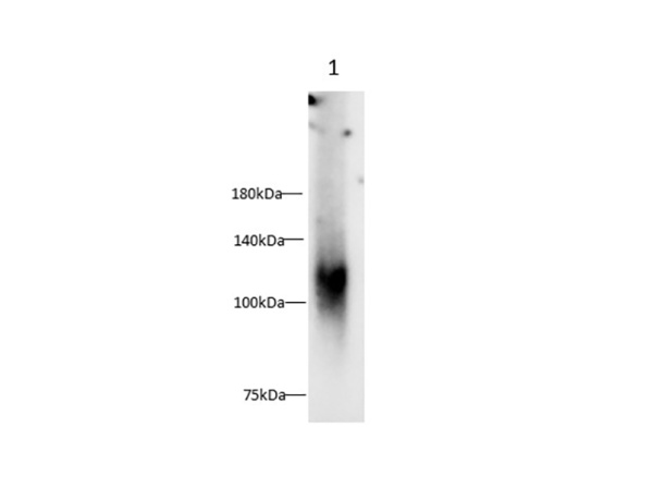 Osteoactivin/GPNMB Polyclonal Antibody (AN007140L)