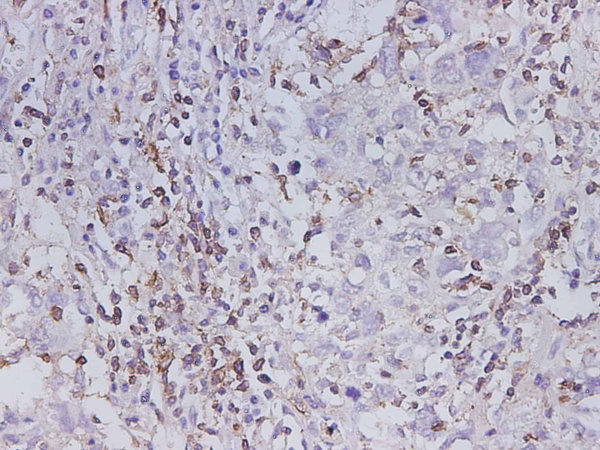MMP-1 Polyclonal Antibody (D-AB-10358L)