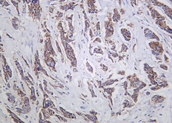 Recombinant G3BP1 Monoclonal Antibody (AN301267L)