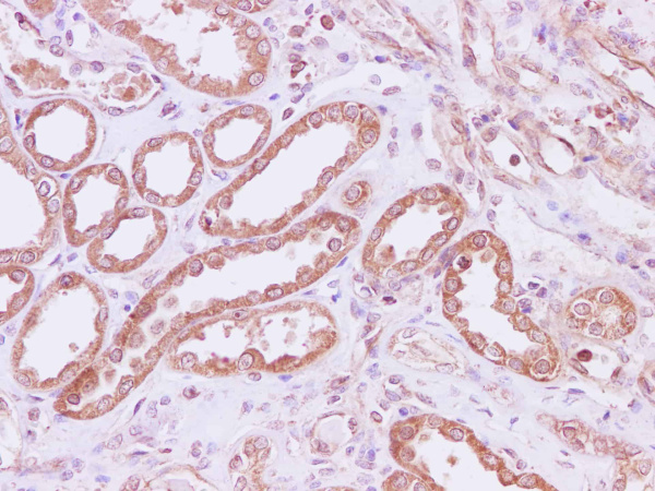 RPLP1 Polyclonal Antibody (E-AB-40244)