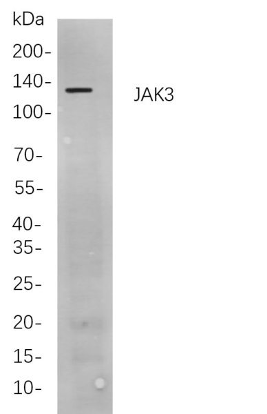 Recombinant JAK3 Monoclonal Antibody (AN300939L)