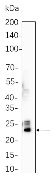 Recombinant GPX4 Monoclonal Antibody (AN300726L)