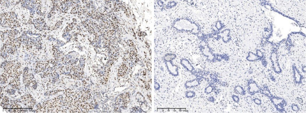 Recombinant Phospho-CREB (Ser133) Monoclonal Antibody (AN300123L)