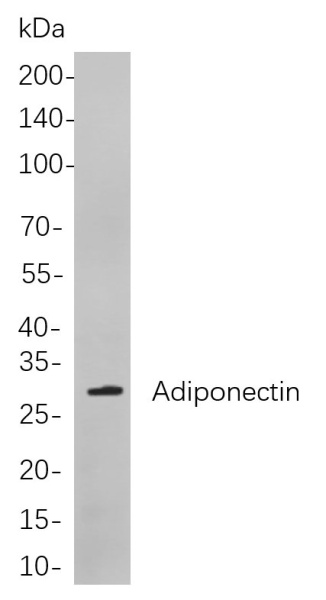 Recombinant Adiponectin Monoclonal Antibody (AN300978L)