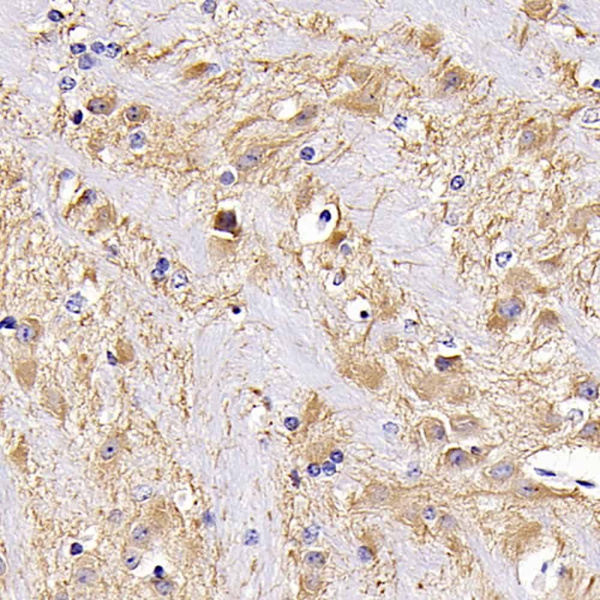 MAP2 Polyclonal Antibody (E-AB-70056)