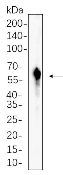 Recombinant RAGE Monoclonal Antibody (AN300605L)