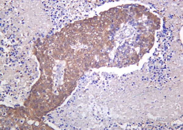 Recombinant PARK7 Monoclonal Antibody (AN301285L)
