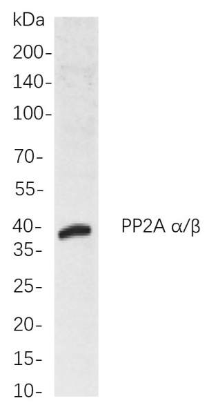 Recombinant PP2A α/β Monoclonal Antibody (AN300875L)