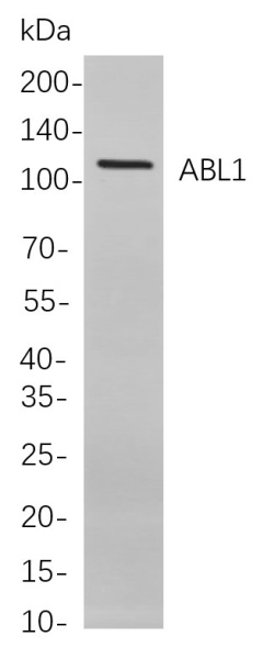 Recombinant ABL1 Monoclonal Antibody (AN300847L)
