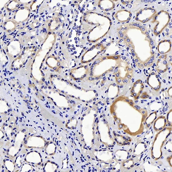 CTGF Polyclonal Antibody (E-AB-70032)