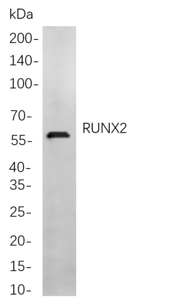 Recombinant RUNX2 Monoclonal Antibody (AN300866L)