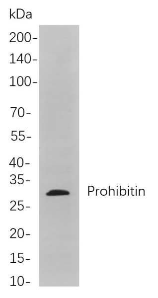 Recombinant Prohibitin Monoclonal Antibody (AN301050L)