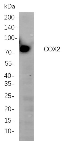 Recombinant COX2 Monoclonal Antibody (AN301043L)